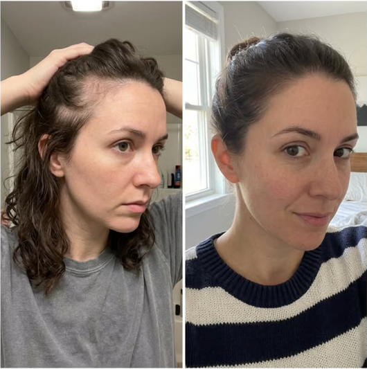 Hair Growth Essence